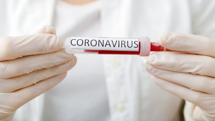 Republica Moldova dispune de teste pentru depustarea virusului COVID-19