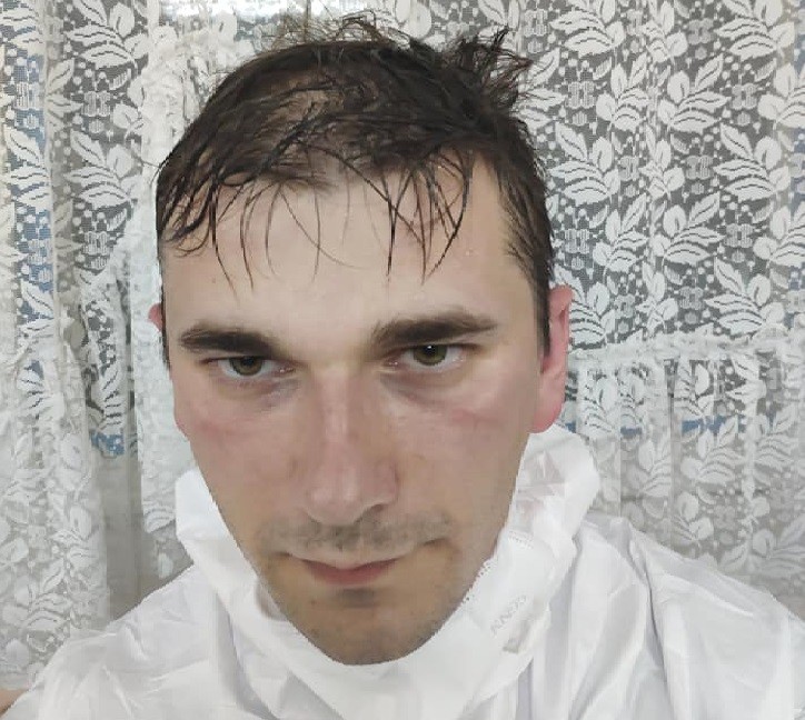 /FOTO/ Cum arată un medic din Bălți după o tură în secția de COVID-19