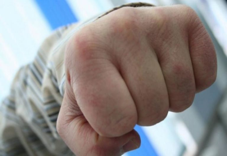 Un bărbat din raionul Briceni a murit pe patul de spital după ce a fost lovit cu pumnul în față