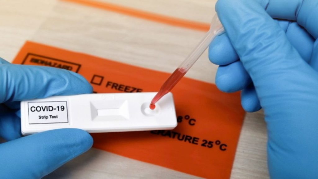 Republica Moldova va cumpăra 300.000 de teste rapide antigen pentru depistarea virusului COVID-19