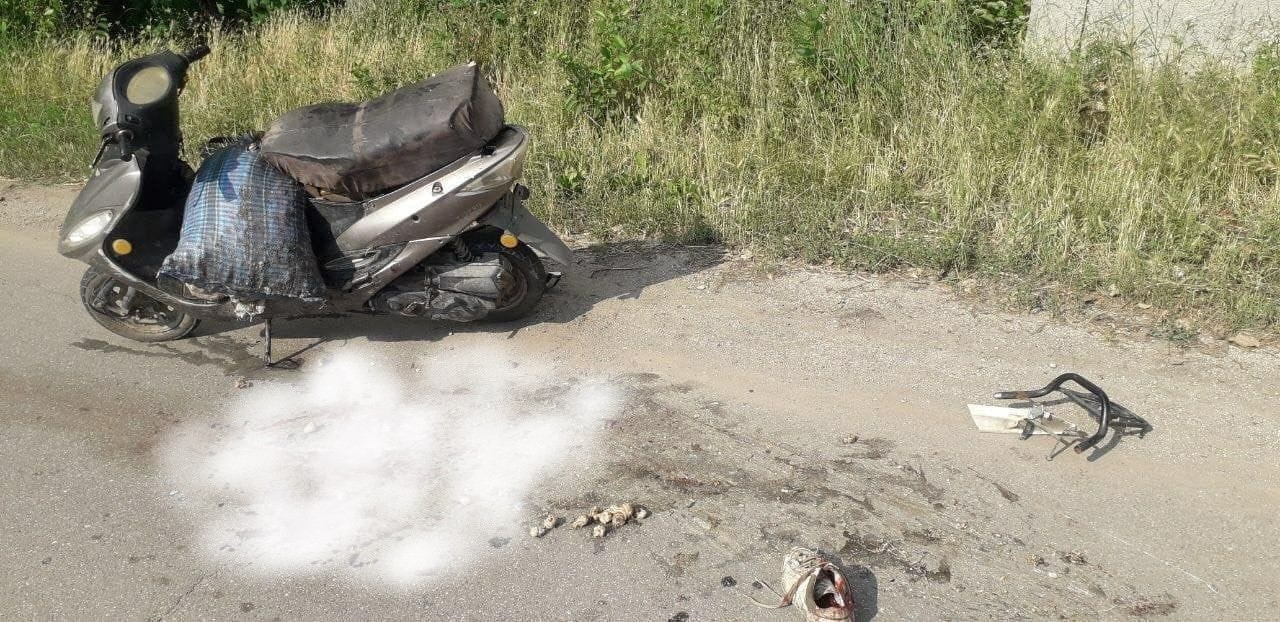 Bărbat în stare de ebrietate ajuns la spital, după un accident cu motoreta în raionul Edineț