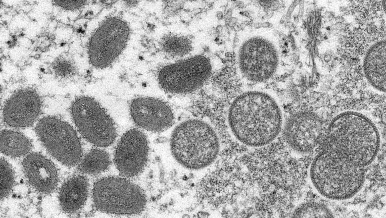 Ce este variola maimuței, noul virus care se răspândește în America și Europa. Care sunt simptomele și cum se transmite